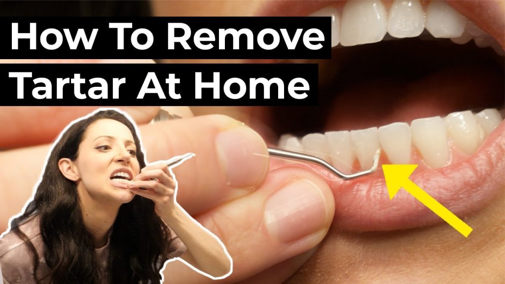 How to Remove Dental Plaque at Home