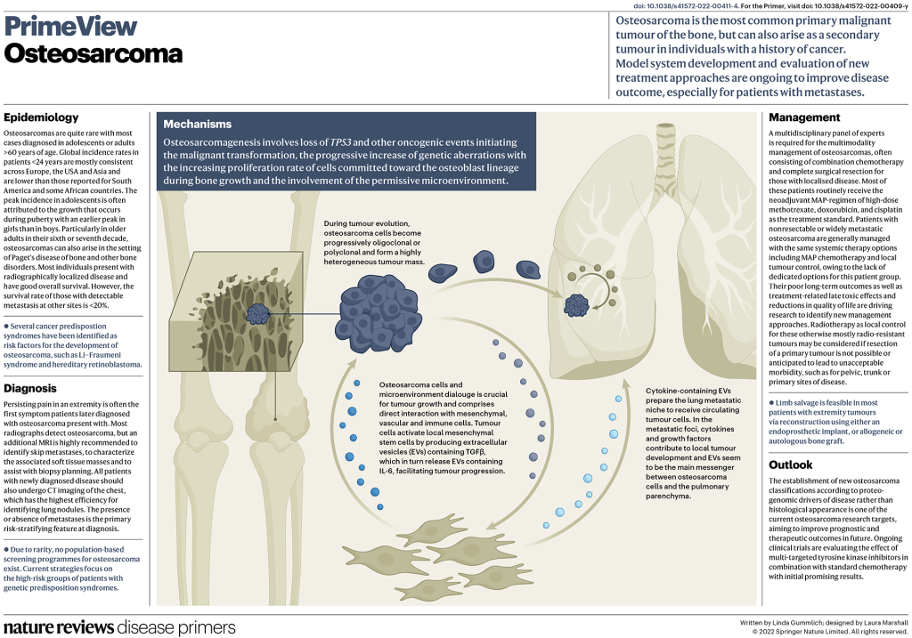 Osteosarcoma