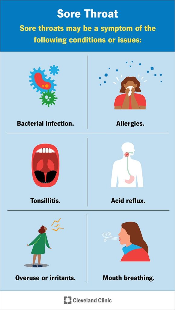 Pharyngitis Symptoms And Treatment