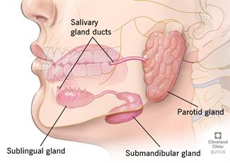 Sialadenitis